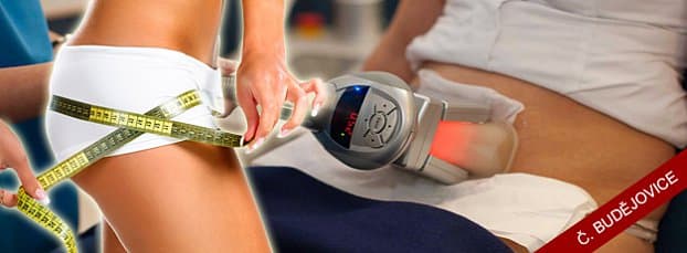 30minutová kryolipolýza přístrojem Cryolipolysis
