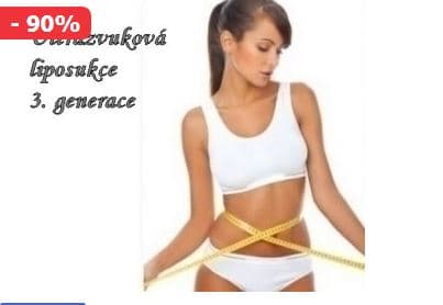 Kryolipolýza či Ultrazvuková liposukce 3. generace