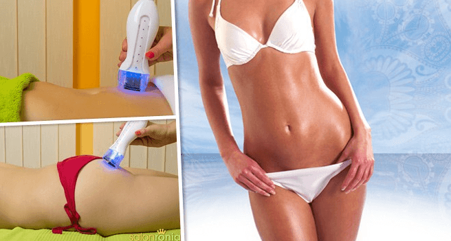 Neinvazivní laserová liposukce Blue Energy Wave 
