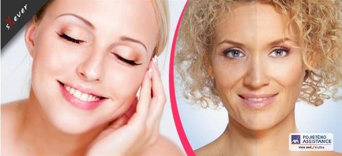 Mikrojehličkování pomocí Dermapenu