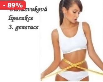 Kryolipolýza či Ultrazvuková liposukce 3. gen.