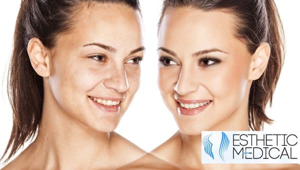 Esthetic Medical: Facelifting balíček 3v1