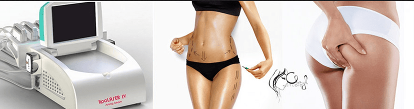 Zeštíhlující laserové liposukce LIPO laserem IV 