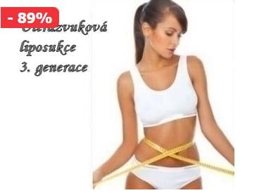 NEOMEZENÁ PERMANENTKA NA HUBNUTÍ (Teplice)