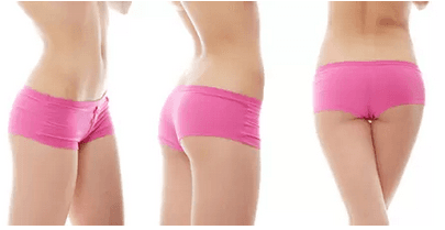 Hubnutí s kryolipolýzou či ultrazvukovou liposukcí
