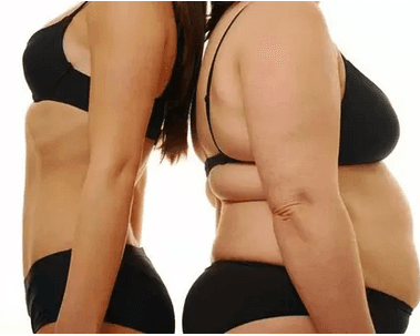 Zhuběte bezbolestně a bez diet s kryolipolýzou 