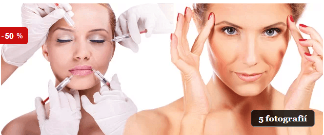 Botox – korekce mimických vrásek