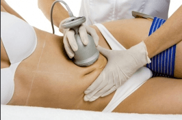 Neinvazivní liposukce (kavitace) libovolné partie 