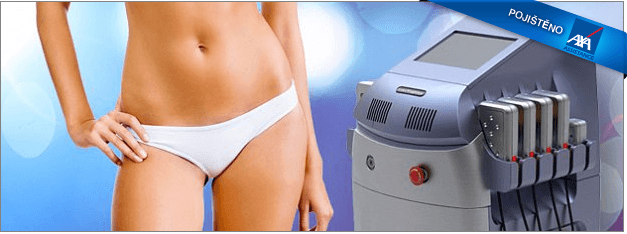 Laserová lipolýza přístrojem GeLipo(Teplice)