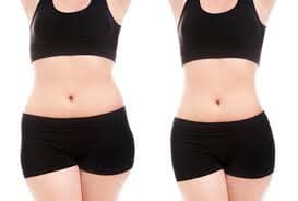 Neinvazivní liposukce přístrojem Claudia Lipo