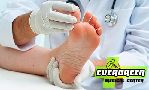 Laserová operace zarůstajících nehtů