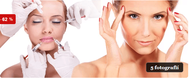 Botox – korekce mimických vrásek