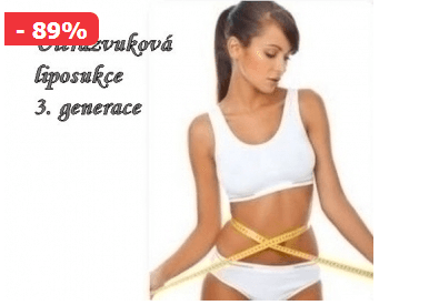 Kryolipolýza či Ultrazvuková liposukce(Teplice)