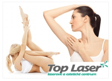 Laserová epilace