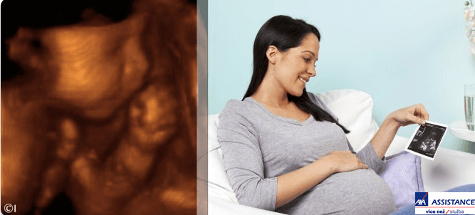 Ultrazvuk 4D v těhotenství fotografie i záznam 