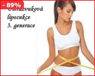 Kryolipolýza či Ultrazvuková liposukce(Teplice)