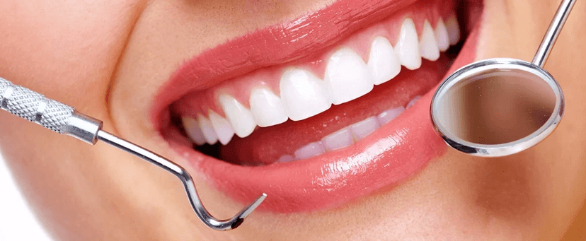 Profesionální dentální hygiena