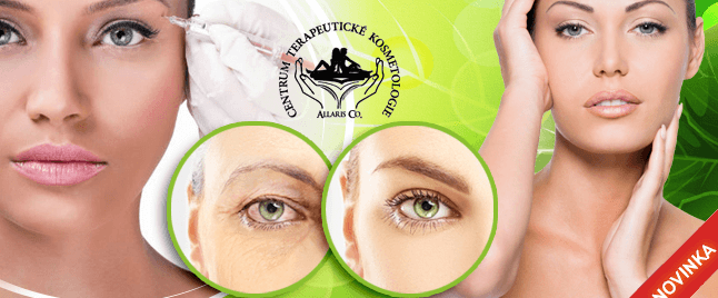 Botox na vyhlazení vrásek nebo proti pocení! 