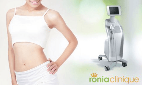 Neinvazivní liposukce přístrojem Liposonix