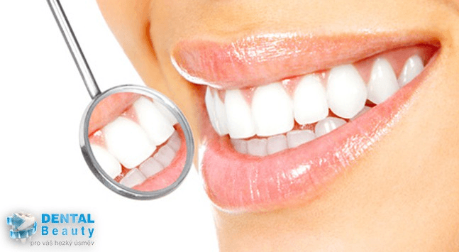 Dentální hygiena v centru Prahy