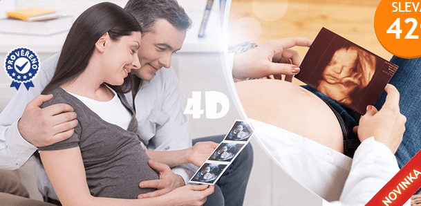 4D ultrazvuk
