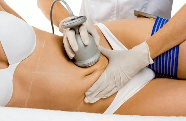 Bezbolestná liposukce s okamžitým účinkem