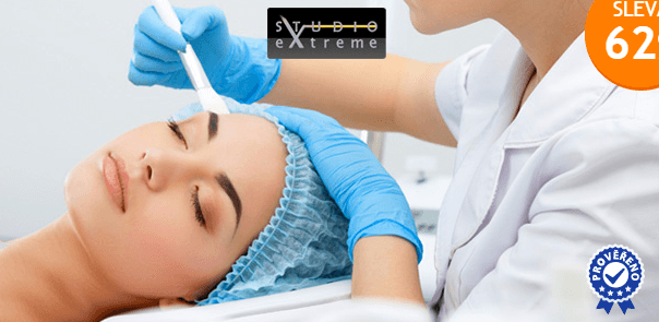 Chemický peeling RETINOL