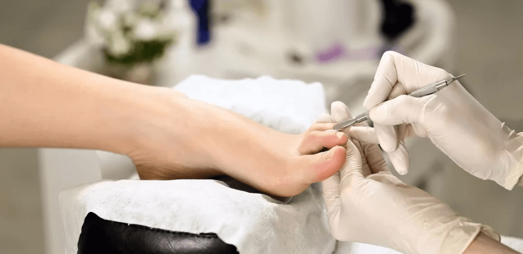 Footlogix – medicinální bezskalpelová pedikúra