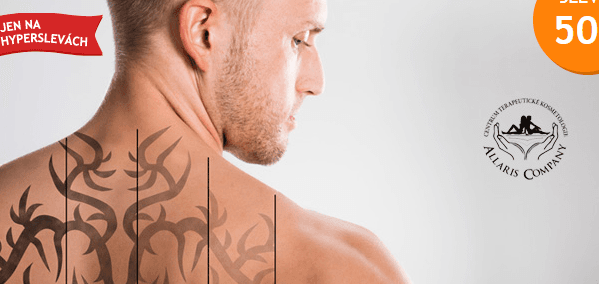 Odstranění tetování metodou Rejuvi Tattoo removal