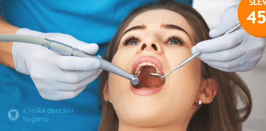 Dentální hygiena včetně AirFlow