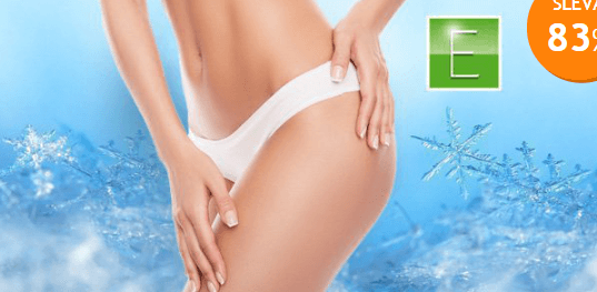 Kryolipolýza = neinvazivní liposukce