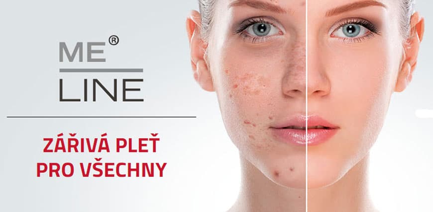 20% sleva na eshopu pigmentace.cz