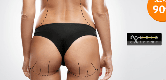 3× celotělové hubnutí v přístroji SlimBox Premium 