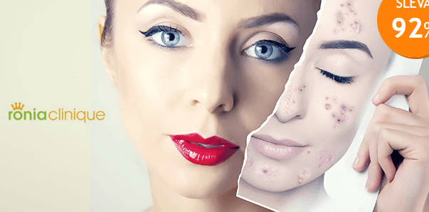 3× fotodepigmentace pro odstranění pigmentu