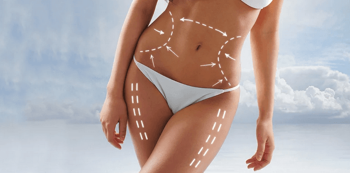 Bodystyling či přístrojová lymfodrenáž