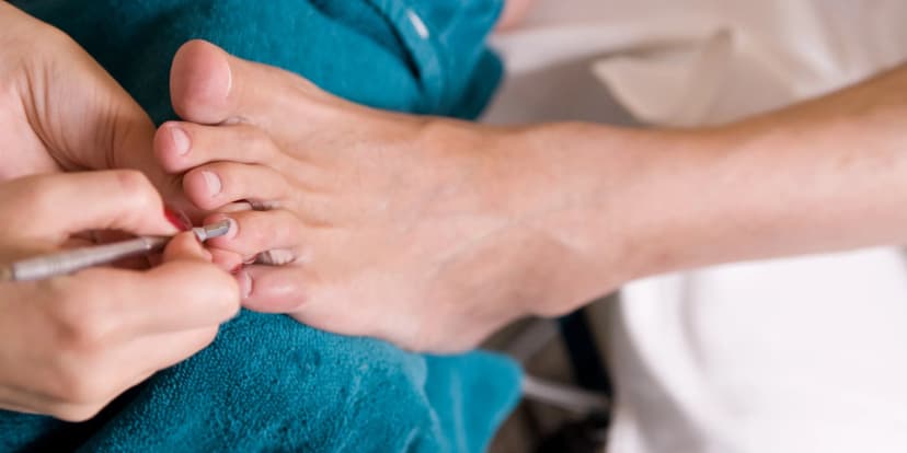 Péče o nohy dle výběru: odstranění kuřích ok, ošetření zarostlých nehtů i aplikace laku