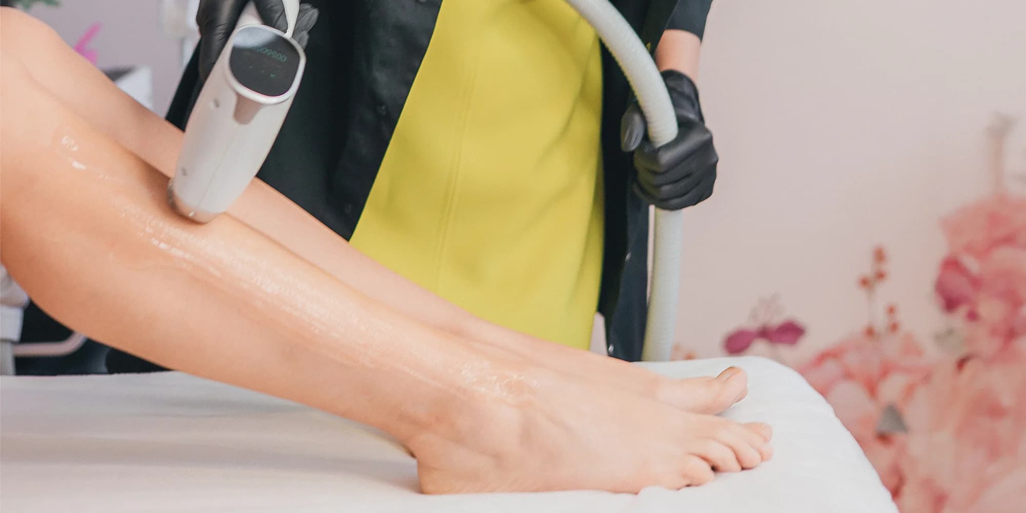 Hladká kůže bez práce: laserová epilace pro ženy – podpaží, nohy i celé tělo