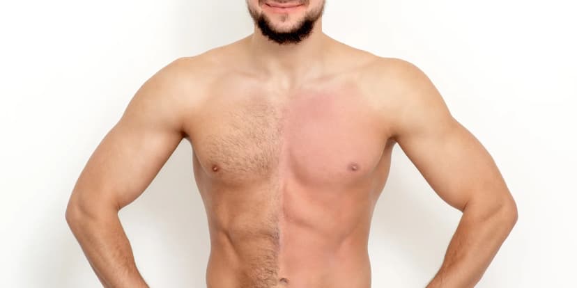 Zbavte se chloupků: depilace vybraných partií cukrovou pastou pro ženy i muže