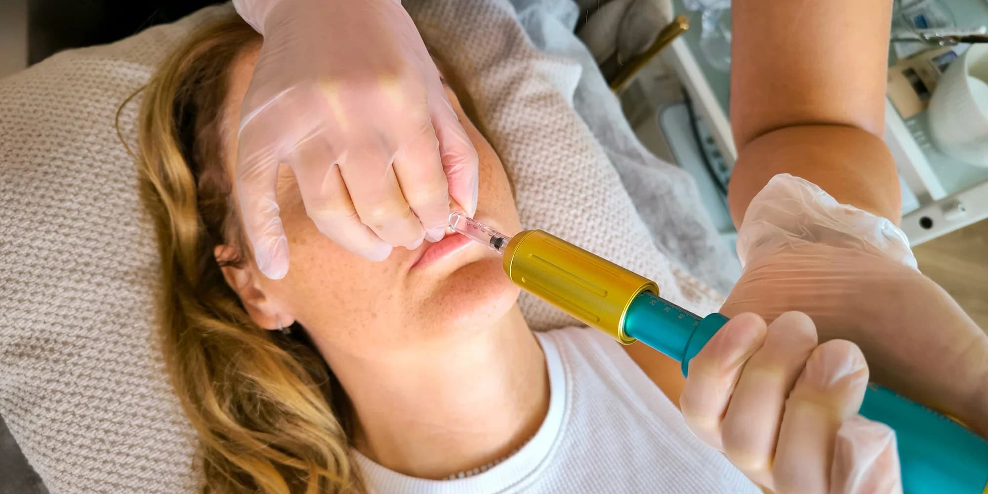 Krásné rty či pleť bez vrásek: jedno nebo dvě ošetření pomocí hyaluron pen