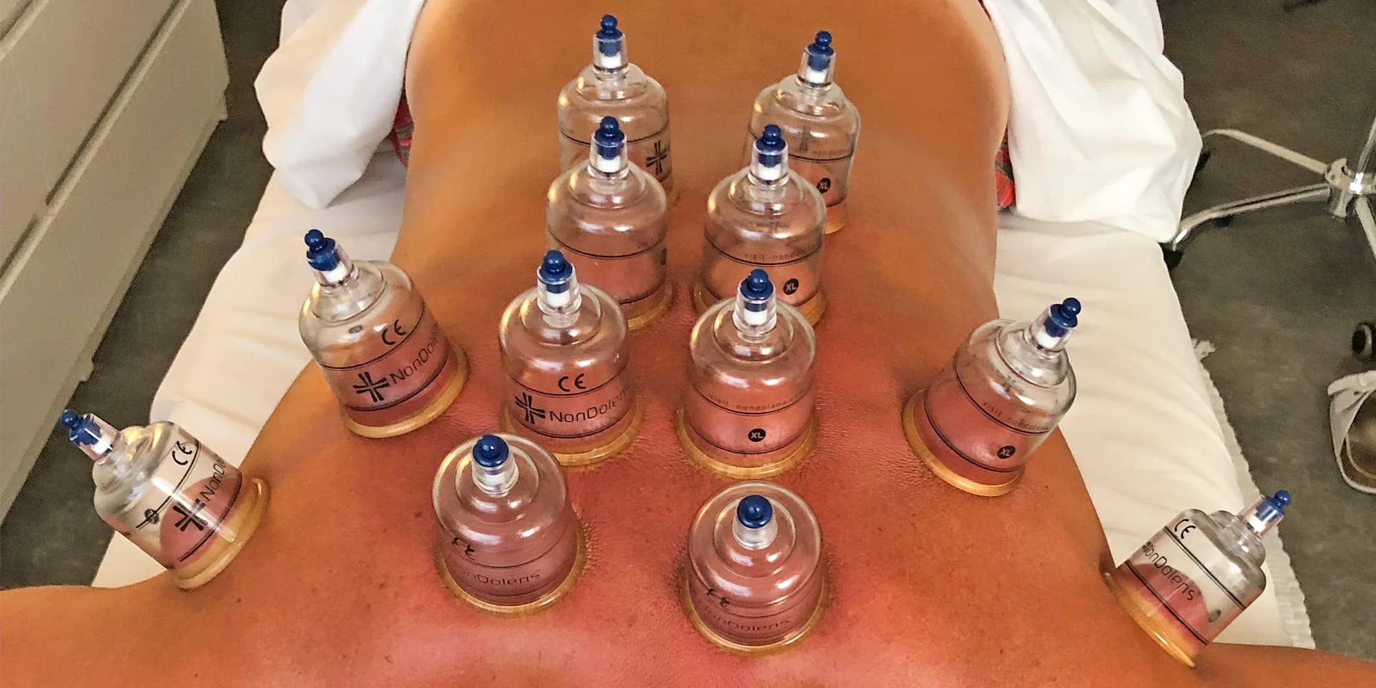 60 nebo 90min. kombinovaná masáž: olejová, trigger points, baňkování i tejpy