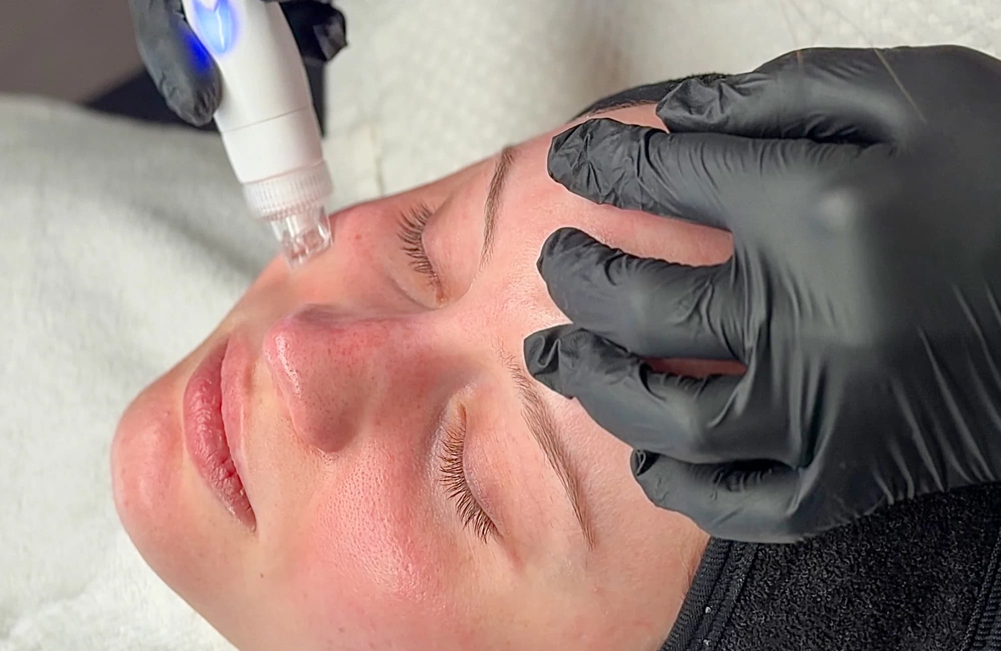 Korejské ošetření pleti, laminace obočí, lash lifting, depilace i kompletní balíček