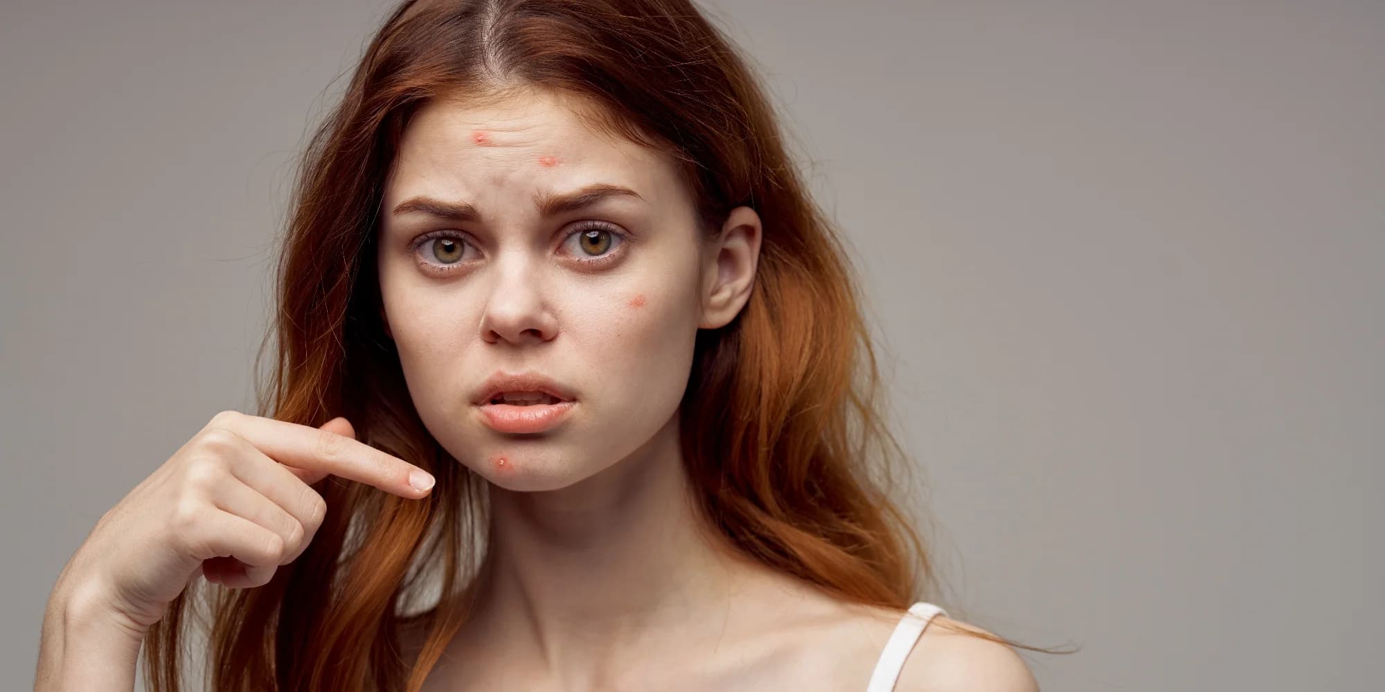 Akné – hloubkové čistění nebo ošetření zánětlivého akné na míru