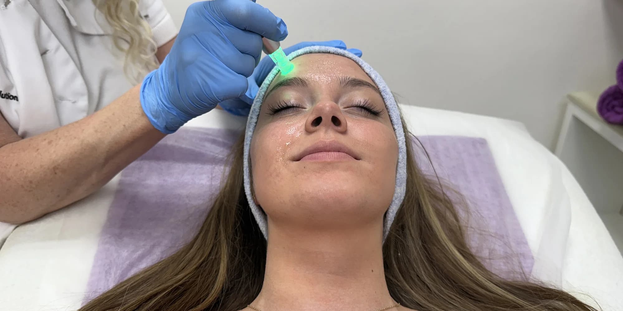 Kosmetická péče pro omlazení pleti: chemický peeling i mikrojehličkování, 1 až 3 ošetření