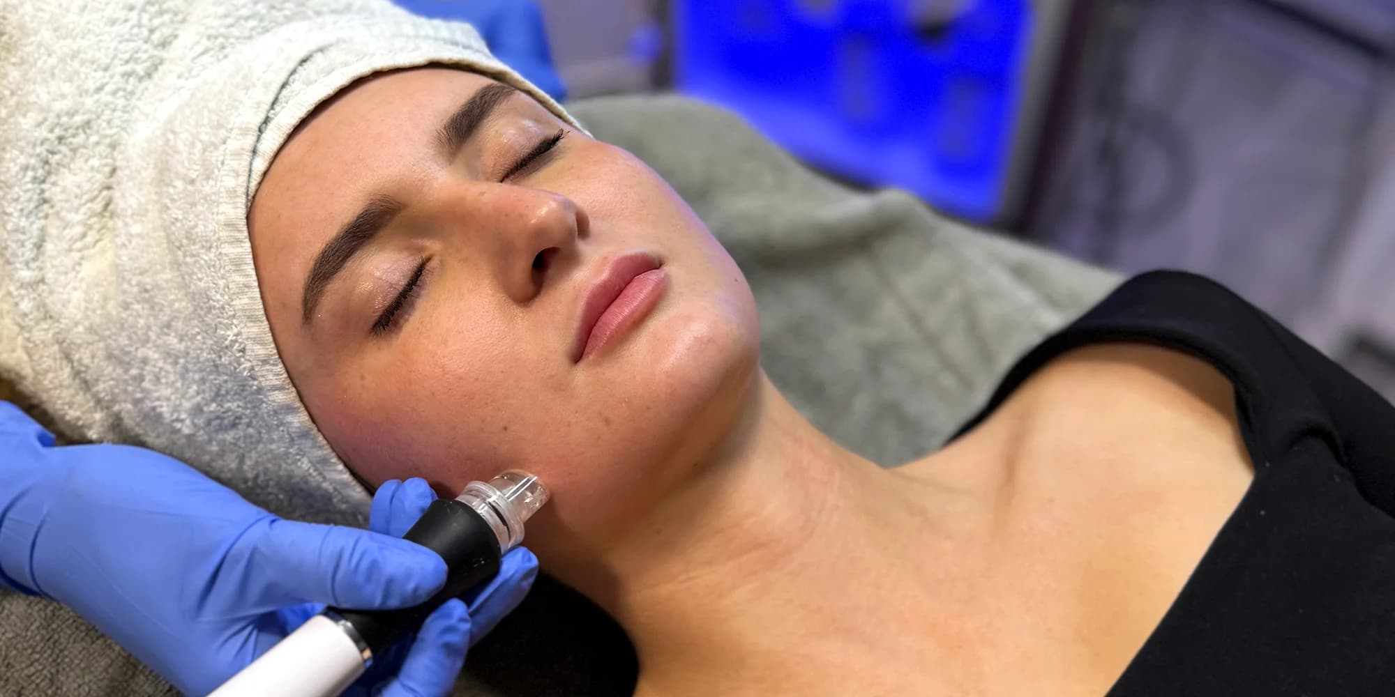 Hloubkové čištění pleti vč. oxygenoterapie a radiofrekvence, 60–90 minut
