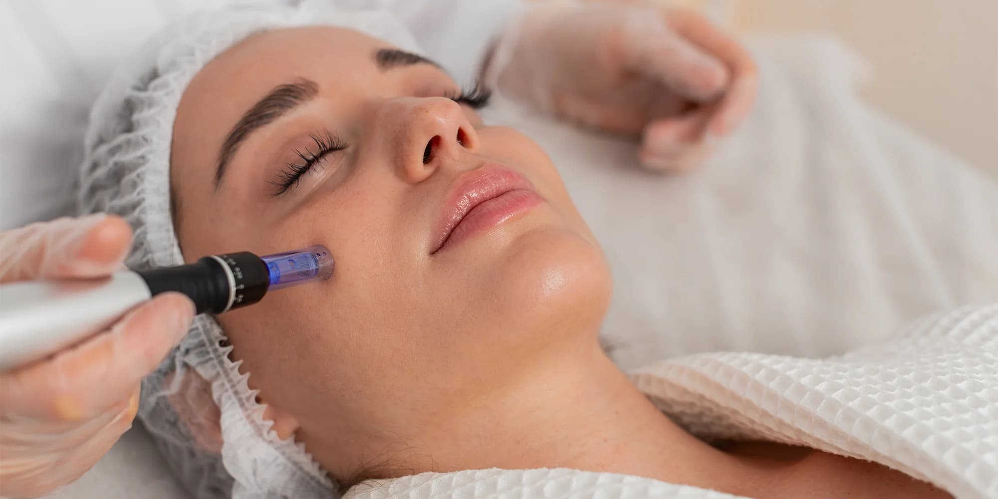 Plasma Pen nebo mikrojehličkování: vyhlazení vrásek, jizev i očních víček