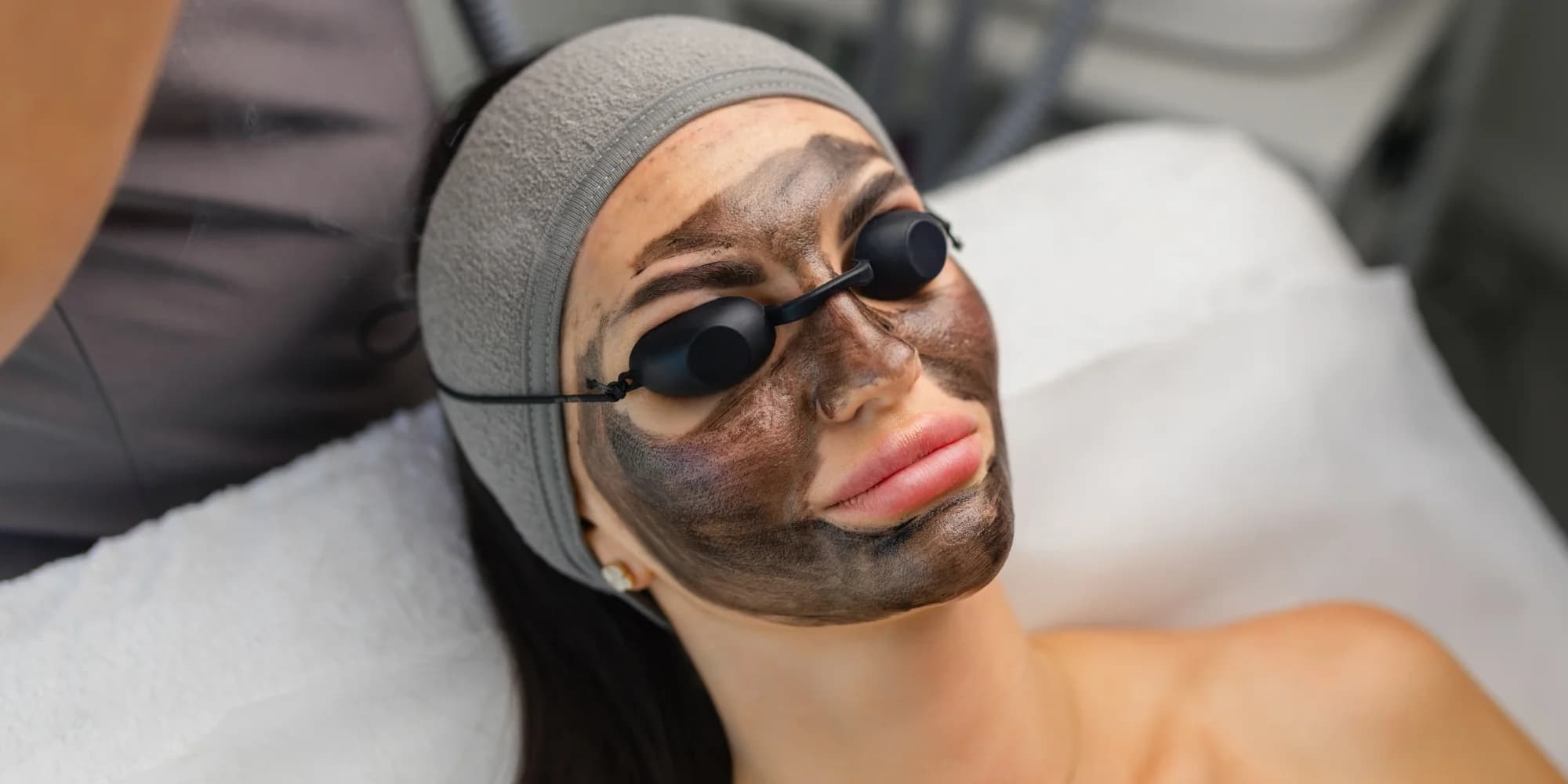 Komplexní péče o pleť: laserový peeling s karbonovou maskou či Dermapeel Pro