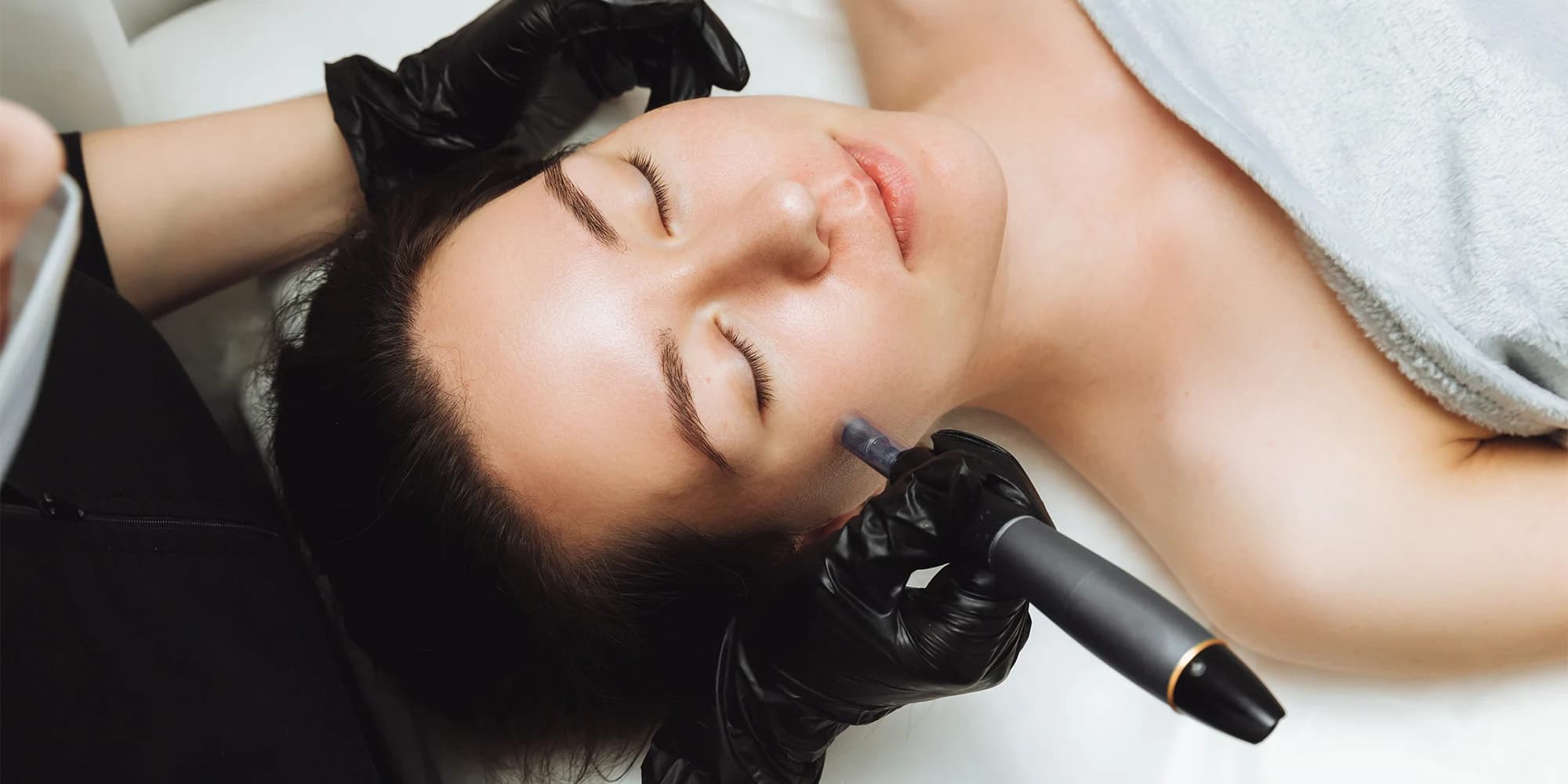 Přístrojové omlazení pleti: peeling, mikrotoky a mezoterapie