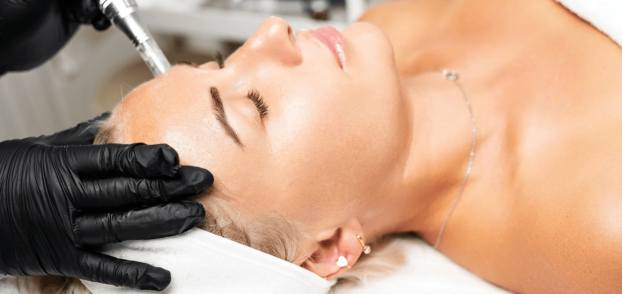 1 ošetření mikrojehličkové mezoterapie obličeje a dekoltu