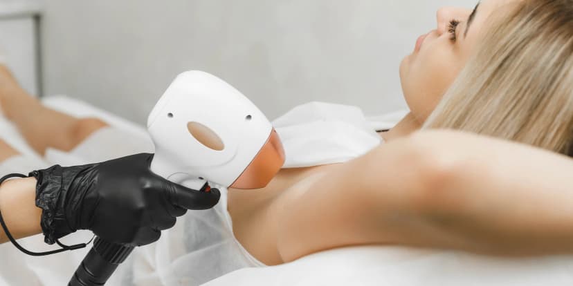 Účinná laserová epilace: nohy, ruce, záda i bikiny či Brazílie
