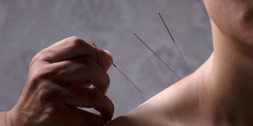 90minutová akupunktura s hloubkovou zdravotní masáží